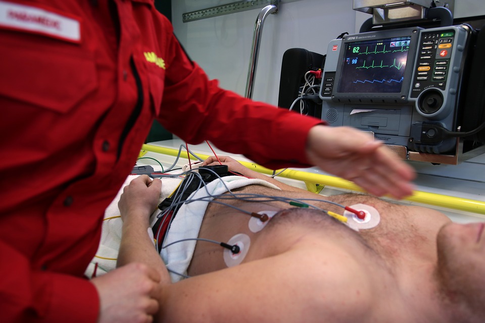 ECG 